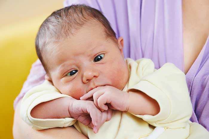 Strabismus (Crossed Eyes)