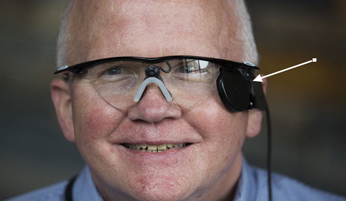 Modern Artificial Eye Prosthetics