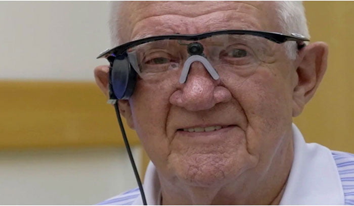 Modern Artificial Eye Prosthetics