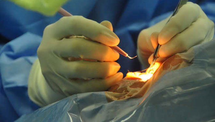Phacoemulsification Cataract Surgery