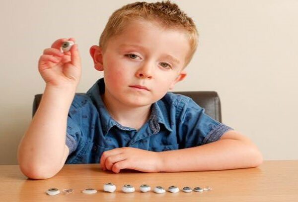 Pediatric eye prosthesis