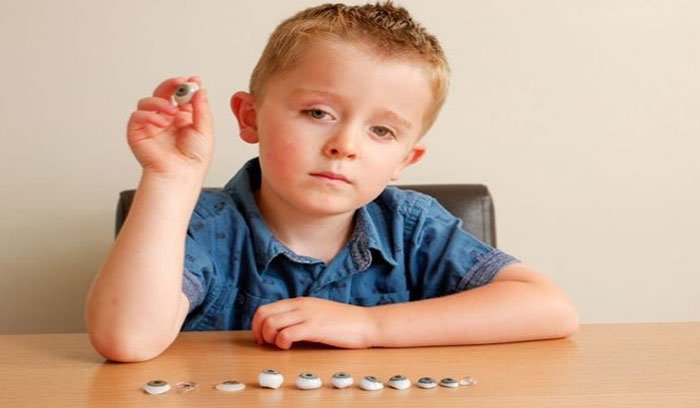 Pediatric eye prosthesis